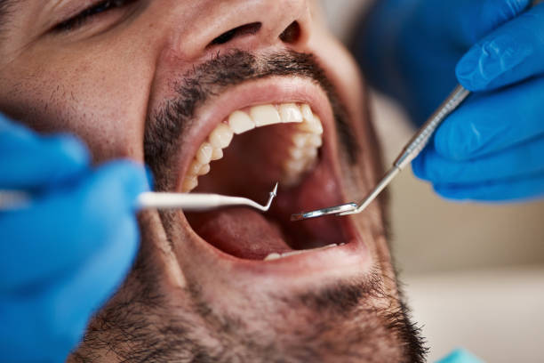 Best Emergency Dentist for Lost Fillings or Crowns in Hawaiian Ocean View, HI